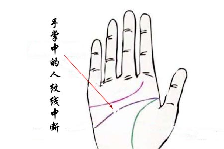 手掌中的人纹线中断.jpg